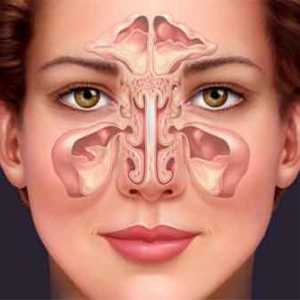 Katara sinusitis: etiologija, simptomi i tretmani