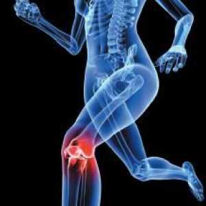 Zglob koljena. Ligamenta ruptura: opseg štete i tretmani