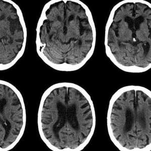 CT glave: postupak mišljenja