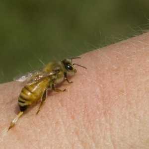Savjetovanje sa stručnjakom: Što učiniti ako ugrizla pčela