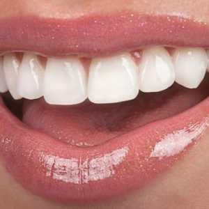 Plastični krune na prednjim zubima: indikacije, recenzije, fotografije