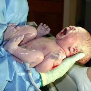 Krvarenje u mozgu novorođenčeta: uzroci i posljedice