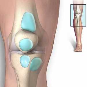 Liječenje burzitis koljena: povratak jednostavan hod