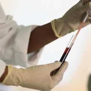 Bijele krvne stanice su povećani u krvi djeteta: Uzrokuje