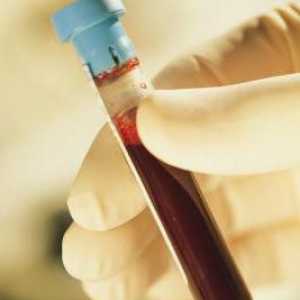 Bijele krvne stanice u urinu djeteta povećana, ili prvi znakovi infekcije