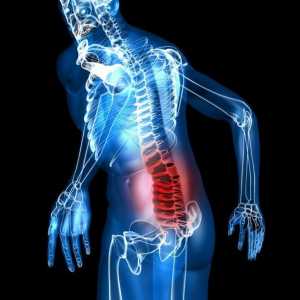 Lumbodinija: što je to? Uzroci, simptomi i tretmani bolova u leđima