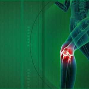 Medicinska koljena s osteoartritisom koljena: kako odabrati?