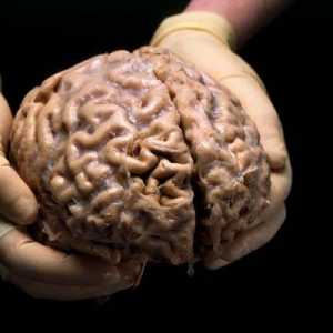 Ljudski mozak: structure