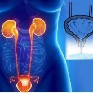 Urinarna inkontinencija u starijih žena: liječenje i uzroci
