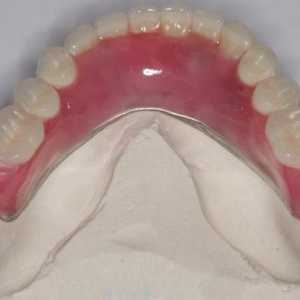 Najlon proteza u odsutnosti zuba i djelomična. Recenzije od najlona proteza