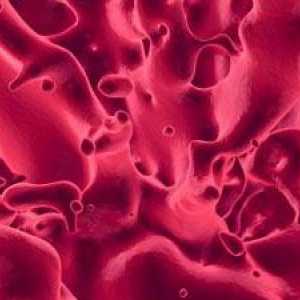 Što se može govoriti o ugrušak krvi za vrijeme menstruacije?
