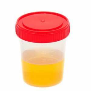 Ono „govori” Analiza urina (dekodiranje) u djece