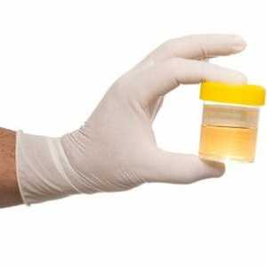 Opći savjeti o tome kako se test urina