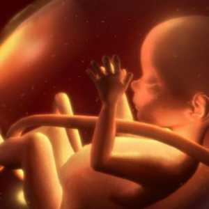 Kabel zaplitanja: uzroci i posljedice. Zašto fetus od pupčane vrpce isprepletenosti?