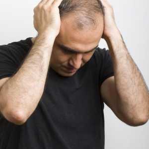 Alopecija areata u muškaraca: tretman narodnih lijekova i lijekova, fotografije, recenzije, razloga