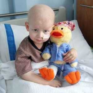 Akutna leukemija u djece