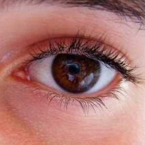 Zašto svrbež očiju? Opis razloga