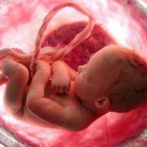 Zašto štucanje djeca u maternici? Verzije i špekulacije