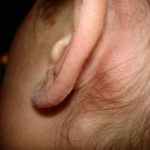 Zašto povećani limfni čvor iza uha