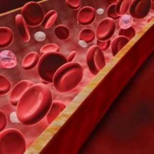 Povećana proteina u krvi: razloga. Biokemijska analiza krvi. ukupno bjelančevina
