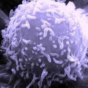 Povećana limfociti: tko je kriv i što učiniti?