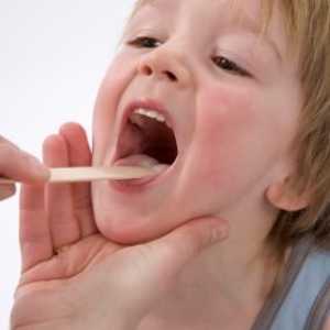Pravilno liječenje u djece adenoiditis