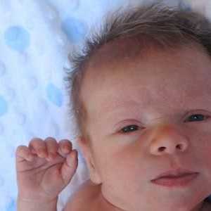 Simptomi i liječenje tortikolis u novorođenčeta