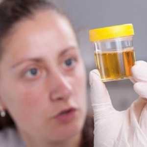 Zašto je oblačno urin u djece?