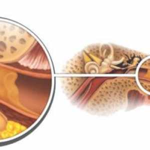 Sumpor u uhu: kada norma pretvori u patologiju