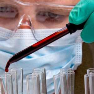 Serološka ispitivanja krvi u dijagnostici bolesti
