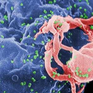 Simptom AIDS: kako se bolest manifestira?