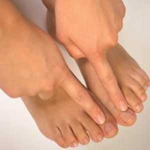 Simptomi noktiju gljiva na noge i karakteristike sorte