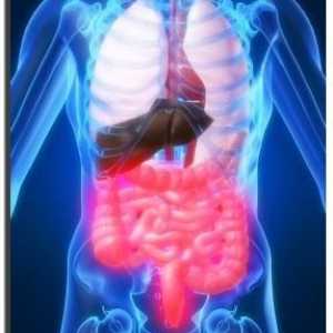 Upalna bolest crijeva: Liječenje, uzroci, simptomi