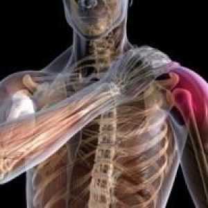 Sport ozljeda ramenog zgloba