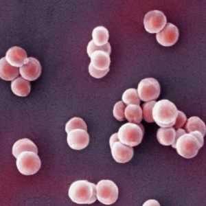 Staphylococcus aureus: što je to i što je opasno?