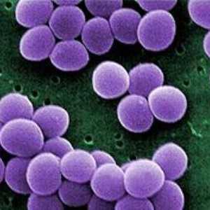 Staphylococcus aureus u dijete: njegove opasnosti, kako ga se riješiti
