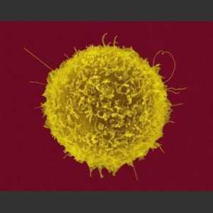 T-pomoćne stanice, što je to? Saznajte što to znači pomoćnih T stanica podignuta ili spuštena