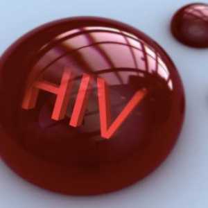 HIV: stadij bolesti