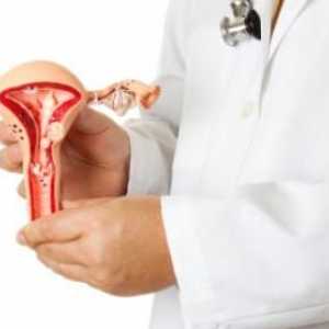 Ženske bolesti. Kako se postupa s ciste jajnika?