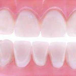 Soft proteze zuba: mišljenja specijalista fotografije